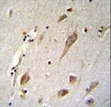 Polyclonal Rabbit anti-Human NXNL2 Antibody (aa80-108, IHC, WB)