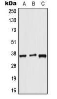 ALX3 Antibody (Internal)