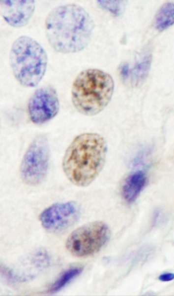 INTS4 Antibody (aa913-963)