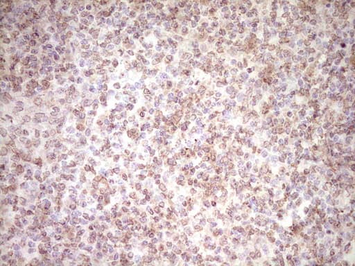 Monoclonal Mouse anti-Human Peripherin Antibody (clone OTI2D5, Carrier-free, IHC, WB)