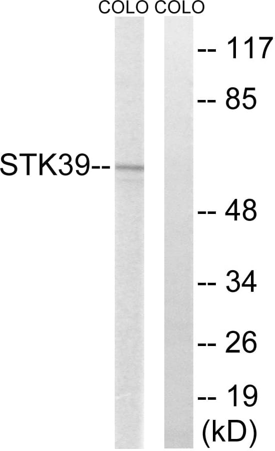 Polyclonal Rabbit anti-Human STK39 / SPAK Antibody (aa351-400, WB)