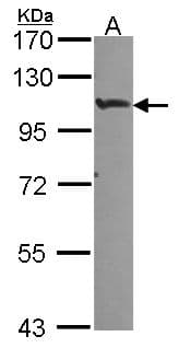 IHC-plus™ HIF2A / EPAS1 Antibody