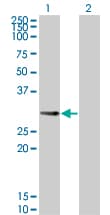 IPP2 / PPP1R2 Antibody (clone 2G11)