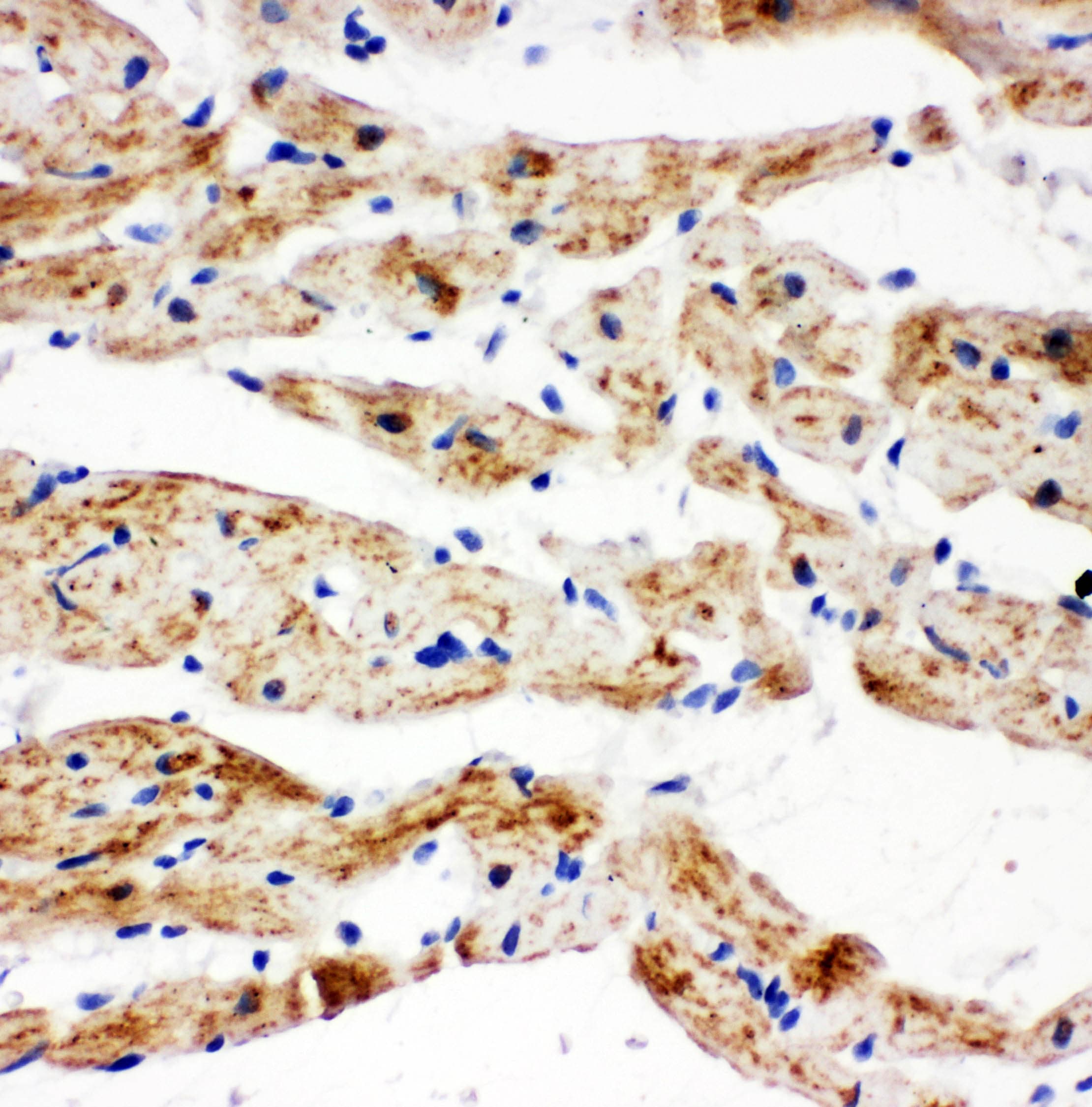 Polyclonal Rabbit anti-Human SDHB Antibody (aa42-59, IHC, WB)