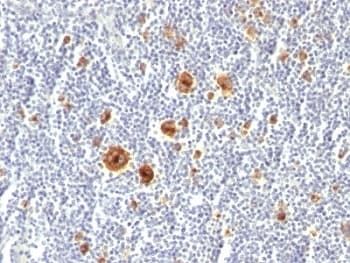 CD30 Antibody (clone Ki-1/779)