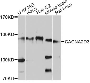 CACNA2D3 / Alpha-2/Delta-3 Antibody
