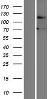 FBXO18 / FBH1 Protein (Over-Expression Lysate Myc-DDK (Flag))
