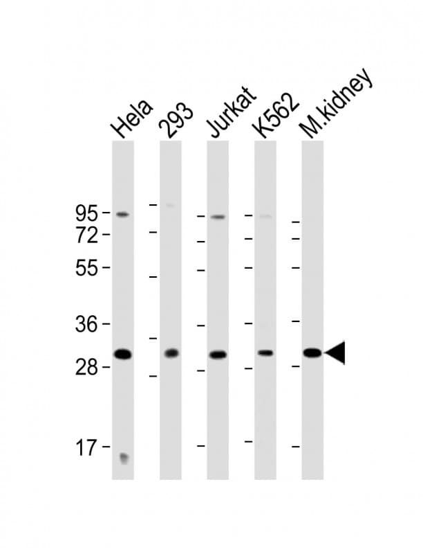 Polyclonal Rabbit anti-Human HOXB4 Antibody (Internal, WB)