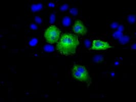 ACAT2 Antibody (clone OTI5A2)