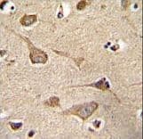 KSR2 Antibody (aa603-638)