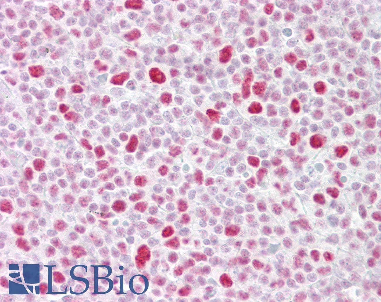 PSME3 Antibody (aa48-97)