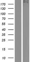 TDRD6 Protein (Over-Expression Lysate Myc-DDK (Flag))