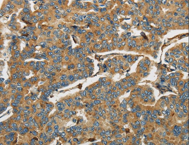 AIF1 / IBA1 Antibody