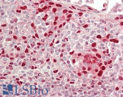 IHC-plus™ STAT1 Antibody (Internal)