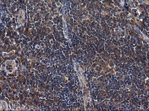 Monoclonal Mouse anti-Human SCRN1 / Secernin 1 Antibody (clone OTI1F2, IHC, WB)