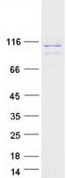 Human RRBP1 / hES Protein (Recombinant Myc-DDK (Flag))