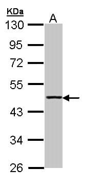 IHC-plus™ ACY1 / Aminoacylase 1 Antibody