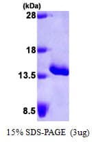 Human Serum Amyloid A Protein (Recombinant His)