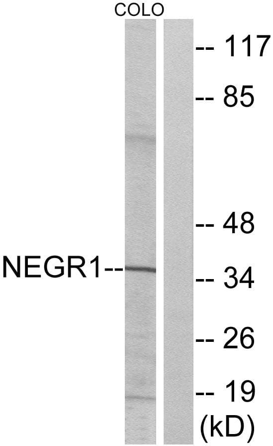 NEGR1 / Neurotractin Antibody