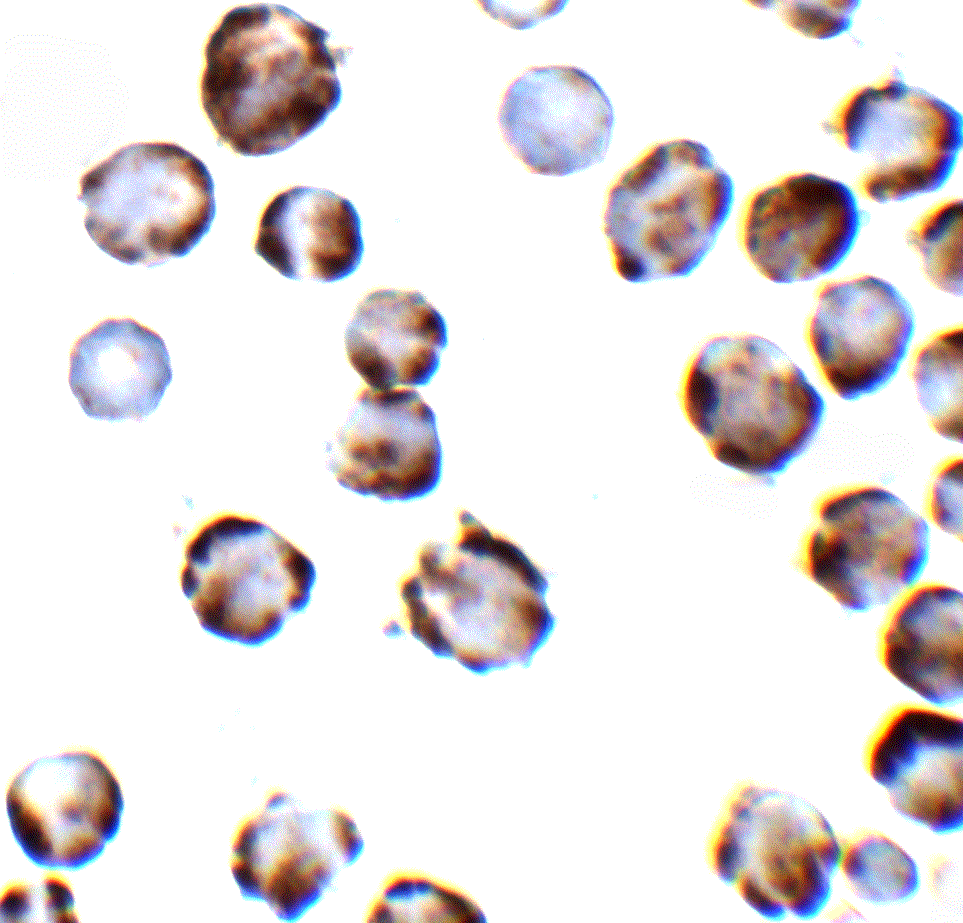 Polyclonal Rabbit anti-Human TRPC6 Antibody (IHC, IF, WB)
