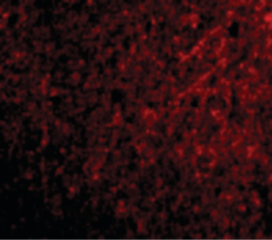 Polyclonal Rabbit anti-Human TSLP Antibody (IHC, IF, WB)