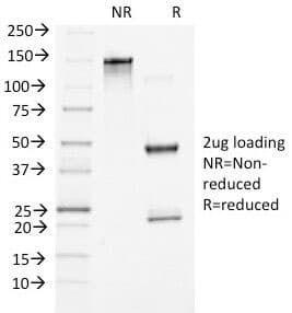 CTNNB1 / Beta Catenin Antibody (clone 5H10)