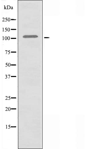 ITPKC Antibody