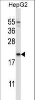 NDUFAF2 / NDUFA12L Antibody (aa71-99)