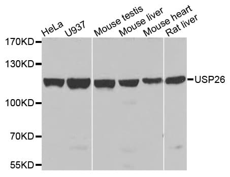 Polyclonal Rabbit anti-Human USP26 Antibody (IHC, IF, WB)