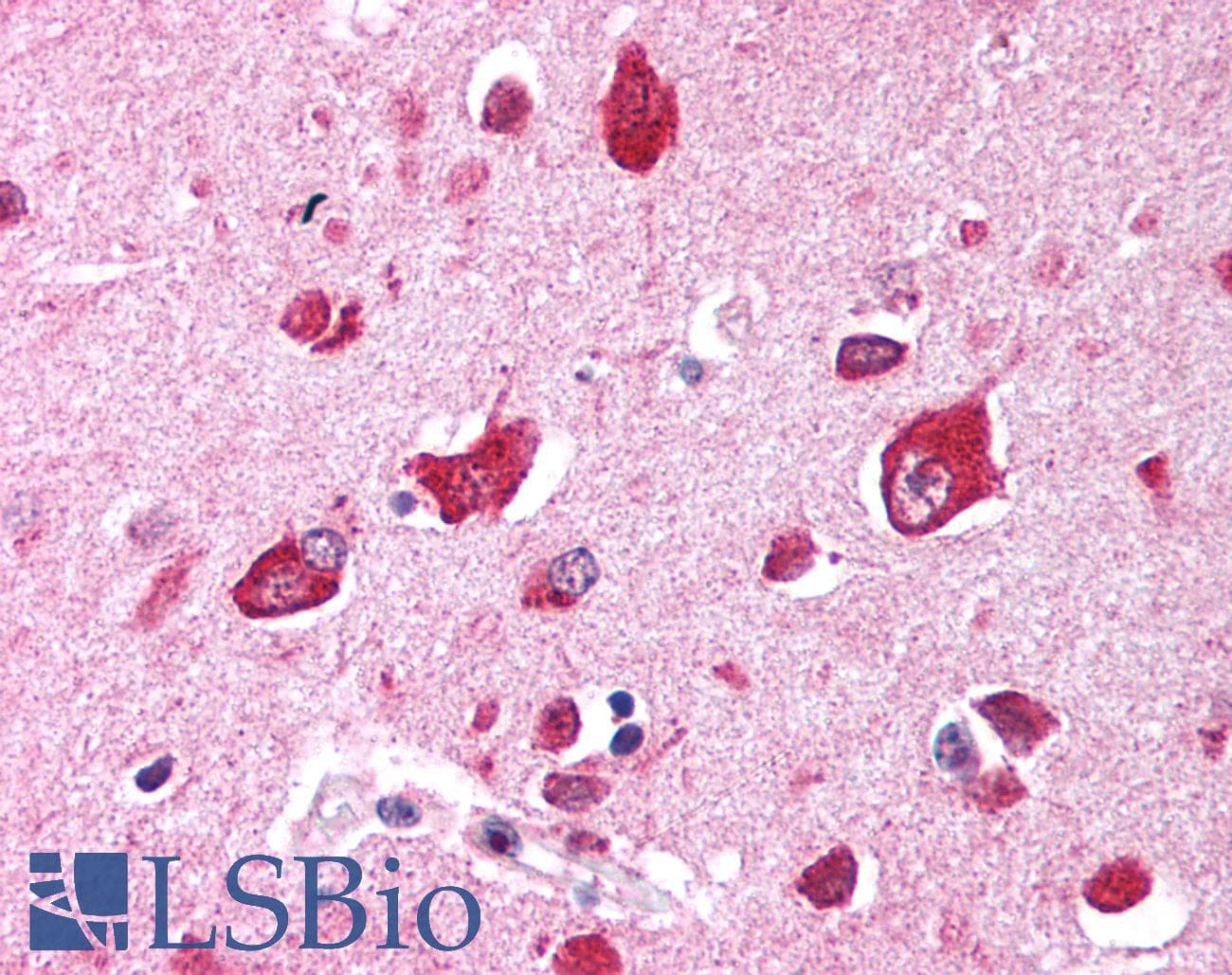 TRIM35 Antibody (aa145-194)