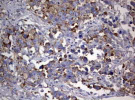 Monoclonal Mouse anti-Human PIK3C2A Antibody (clone OTI2D9, aa230-560, IHC, WB)