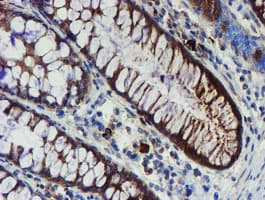 PPAT Antibody (aa42-278, clone OTI1B8)