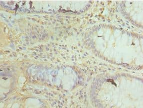 COXIV / COX4 Antibody (aa23-169)
