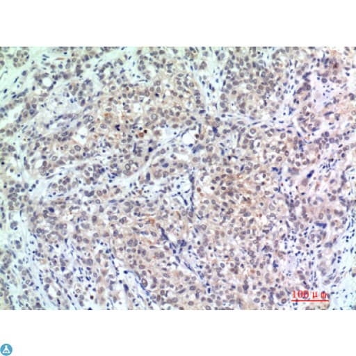 EP300 / p300 Antibody