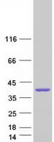 Human PARVG Protein (Recombinant Myc-DDK (Flag))