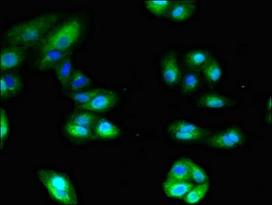 Polyclonal Rabbit anti-Human ANPEP / CD13 Antibody (IHC, IF, WB)