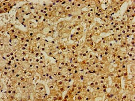Polyclonal Rabbit anti-Human RASSF1 / RASSF1A Antibody (IHC)