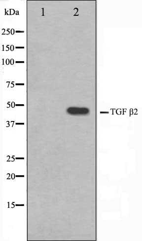 Polyclonal Rabbit anti-Human TGFB2 / TGF Beta2 Antibody (IHC, WB)