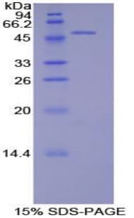 Rat PECAM-1 / CD31 Protein (Recombinant His-GST)