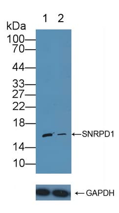 SNRPD1 / SMD1 Antibody (aa1-119)