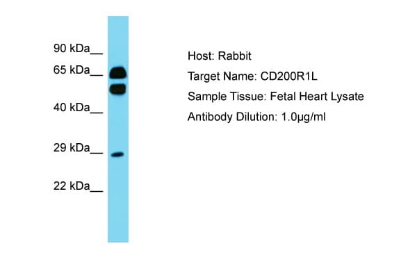 Polyclonal Rabbit anti-Human CD200R1L Antibody (aa87-136, WB)