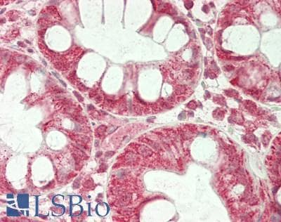 PSIP1 / LEDGF Antibody (aa311-360)