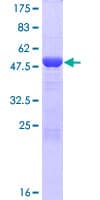 Human ECE2 Protein (Recombinant GST)