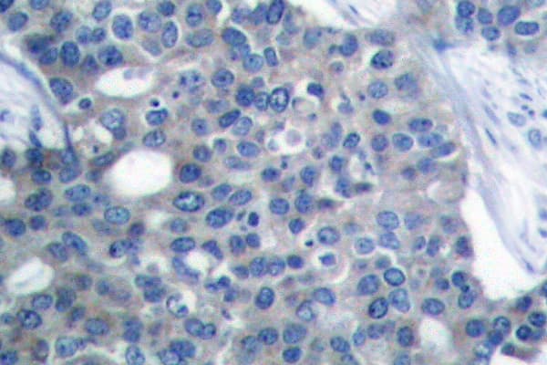 STMN1 / Stathmin / LAG Antibody (Ala18)