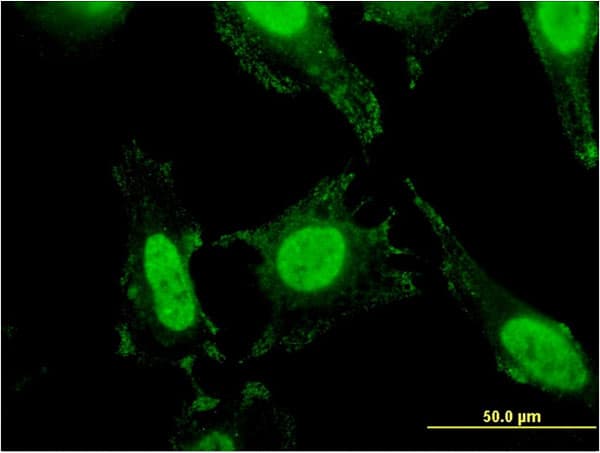 IHC-plus™ Monoclonal Mouse anti-Human SLC4A1 / Band 3 / AE1 Antibody (clone 2D5, IHC, IF, WB)
