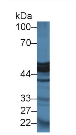 CPA1 / Carboxypeptidase A Antibody (aa205-419)