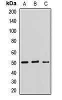 Polyclonal Rabbit anti-Human LHX9 Antibody (WB)