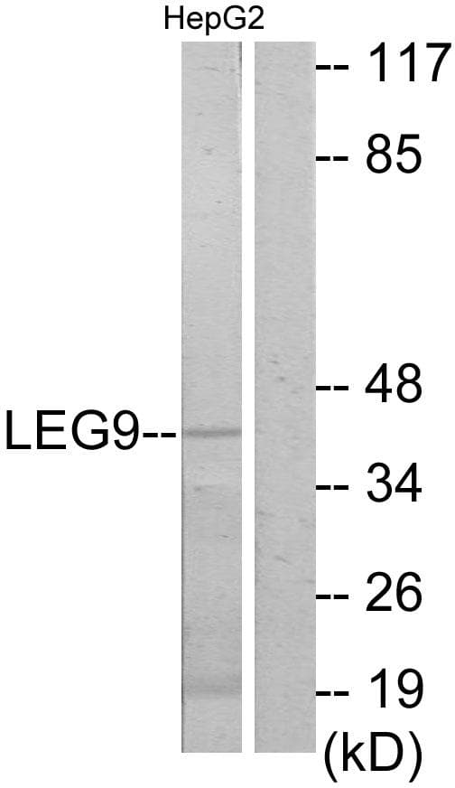 LGALS9 / Galectin 9 Antibody
