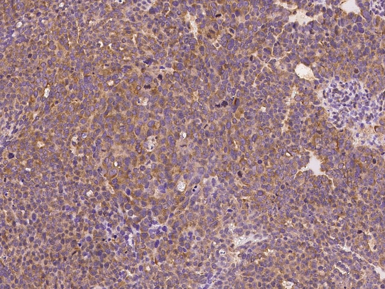 Polyclonal Rabbit anti-Human RALB Antibody (IHC)