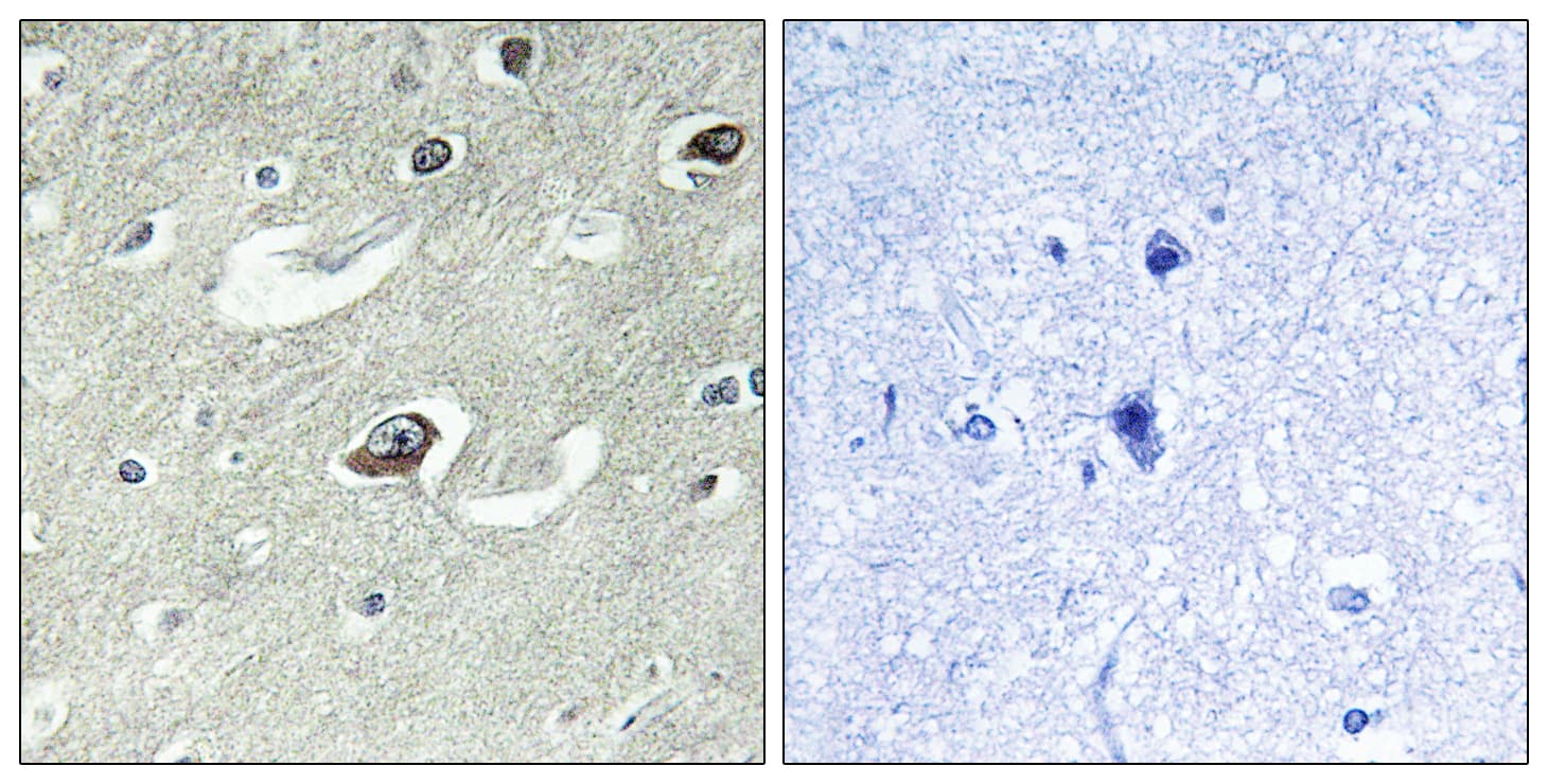 Polyclonal Rabbit anti-Human RAB6KIFL / KIF20A Antibody (aa501-550, IHC, IF, WB)